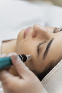 Derma pen